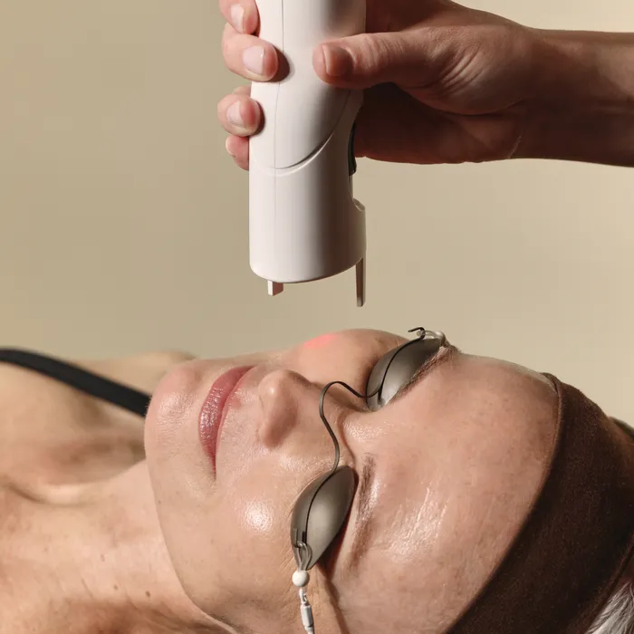 The laser facial treatment